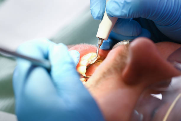 Best Emergency Tooth Extraction in Valley Forge, TN